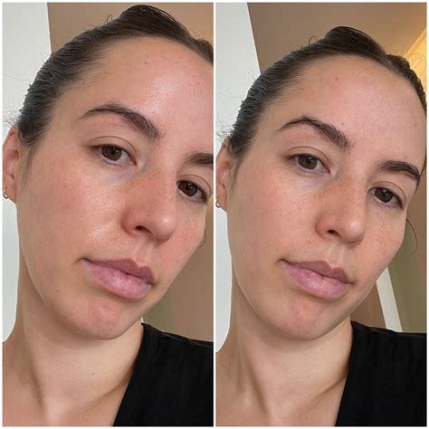 face roller before and after|Iba pa.